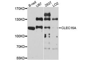 Western blot analysis of extracts of various cell lines, using CLEC16A antibody (ABIN5996330) at 1/1000 dilution. (CLEC16A anticorps)