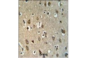UPK1B Antibody (Center) (ABIN653680 and ABIN2843007) IHC analysis in formalin fixed and paraffin embedded brain tissue followed by peroxidase conjugation of the secondary antibody and DAB staining. (Uroplakin 1B anticorps  (AA 159-188))