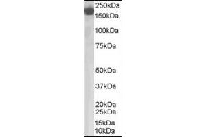 Image no. 2 for anti-Complement Factor H (CFH) (Internal Region) antibody (ABIN372860)