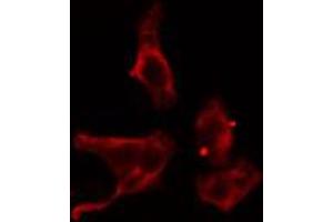 ABIN6274579 staining Hela cells by IF/ICC. (ADCY4 anticorps  (Internal Region))