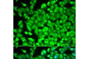 Immunofluorescence analysis of MCF-7 cells using FBP1 Polyclonal Antibody (FBP1 anticorps)