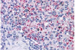 Human Spleen: Formalin-Fixed, Paraffin-Embedded (FFPE) (Integrin beta 3 anticorps)