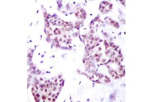 Immunohistochemistry (IHC) image for anti-Signal Transducer and Activator of Transcription 6, Interleukin-4 Induced (STAT6) (pTyr641) antibody (ABIN1870652) (STAT6 anticorps  (pTyr641))