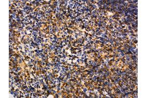 MUM1 Antibody at 1/100 staining Mouse spleen tissue by IHC-P. (MUM1 anticorps  (C-Term))