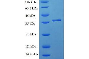 Immature Colon Carcinoma Transcript 1 (ICT1) (AA 30-206) protein (His-SUMO Tag)