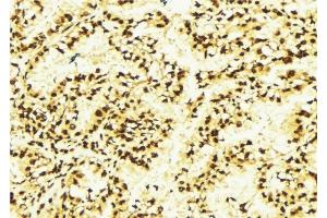 ABIN6277637 at 1/100 staining Human lung tissue by IHC-P. (TFCP2 anticorps  (Internal Region))