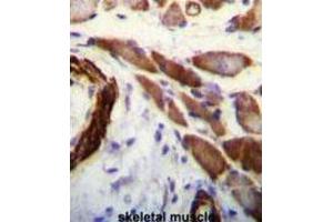 Immunohistochemistry (IHC) image for anti-Filamin A, alpha (FLNA) antibody (ABIN3003482) (Filamin A anticorps)