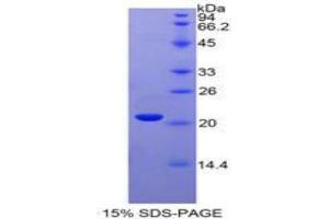 SDS-PAGE analysis of Human Interferon alpha 4 Protein.