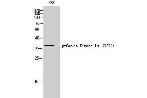 Western Blotting (WB) image for anti-Casein Kinase 1, alpha 1 (CSNK1A1) (pTyr294) antibody (ABIN3182662) (CSNK1A1 anticorps  (pTyr294))