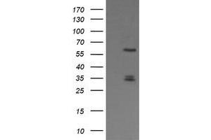 Image no. 1 for anti-Polo-Like Kinase 1 (PLK1) antibody (ABIN1500284) (PLK1 anticorps)