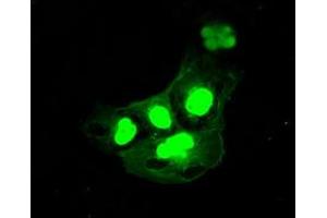 Image no. 1 for anti-DNA Fragmentation Factor, 45kDa, alpha Polypeptide (DFFA) antibody (ABIN1498772)
