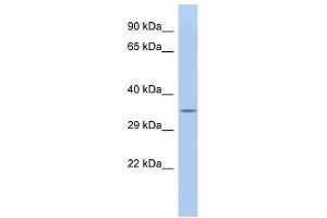 Calbindin 2 antibody used at 1 ug/ml to detect target protein. (Calretinin anticorps  (N-Term))
