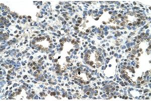 Human Lung (Osteoactivin anticorps  (N-Term))