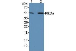 Figure. (SERPINA7 anticorps  (AA 128-415))