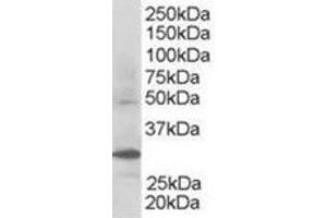 Image no. 2 for anti-F-Box and WD Repeat Domain Containing 2 (FBXW2) (C-Term) antibody (ABIN374352) (FBXW2 anticorps  (C-Term))