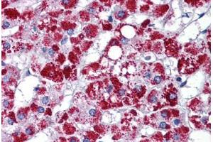 Human Adrenal: Formalin-Fixed, Paraffin-Embedded (FFPE)