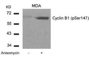 Image no. 3 for anti-Cyclin B1 (CCNB1) (pSer147) antibody (ABIN401595) (Cyclin B1 anticorps  (pSer147))