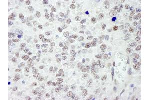 anti-RAN Binding Protein 3 (RANBP3) (AA 150-200) antibody