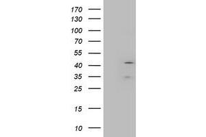 Western Blotting (WB) image for anti-Layilin (LAYN) antibody (ABIN1499101) (Layilin anticorps)