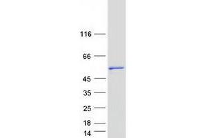 Validation with Western Blot