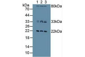 Western blot analysis of (1) Human HeLa cells, (2) Human Jurkat Cells and (3) Human MCF7 Cells. (Dual Specificity Phosphatase 3 (DUSP3) (AA 2-185) anticorps)
