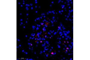 Immunofluorescence of paraffin embedded rat hippocampus using groucho (ABIN7075961) at dilution of 1:1000 (350x lens) (TLE1 anticorps)