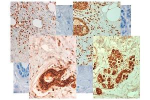 Immunohistochemistry (IHC) image for anti-ATP-Binding Cassette, Sub-Family B (MDR/TAP), Member 5 (ABCB5) (Internal Region) antibody (ABIN349592)