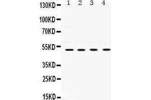 Western Blotting (WB) image for anti-Ubiquitin-Conjugating Enzyme E2Q Family Member 2 (UBE2Q2) (AA 83-123), (N-Term) antibody (ABIN3043953) (UBE2Q2 anticorps  (N-Term))