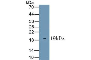 Detection of Recombinant KISS1, Human using Polyclonal Antibody to Kisspeptin 1 (KISS1) (KISS1 anticorps  (AA 20-138))