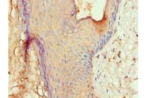 Immunohistochemistry of paraffin-embedded human skin tissue using ABIN7144532 at dilution of 1:100 (ALOX15B anticorps  (AA 1-200))