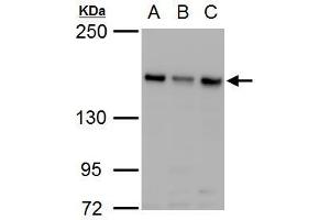 WB Image ROCK2 antibody detects ROCK2 protein by western blot analysis. (ROCK2 anticorps)