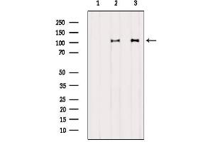 Western blot analysis of extracts from various samples, using DDX58  Antibody. (DDX58 anticorps  (N-Term))