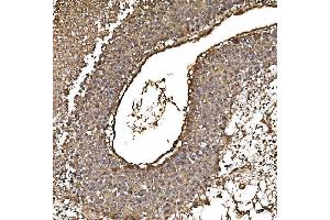 IHC analysis of PARK7/DJ1 using anti-PARK7/DJ1 antibody (ABIN7600468). (PARK7/DJ1 anticorps  (AA 2-189))