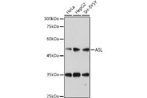 Western blot analysis of extracts of various cell lines, using ASL antibody (ABIN6127448, ABIN6137201, ABIN6137202 and ABIN6221972) at 1:1000 dilution. (ASL anticorps  (AA 1-300))