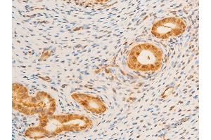 ABIN6267237 at 1/100 staining rat uterine tissue sections by IHC-P.