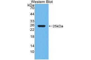 Western blot analysis of the recombinant protein. (Growth Hormone 1 anticorps  (AA 28-216))