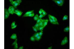 Immunofluorescence staining of HepG2 cells with ABIN7168164 at 1:266, counter-stained with DAPI. (LAS1L anticorps  (AA 490-565))