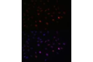 Immunofluorescence analysis of C6 cells using SRSF3 antibody (ABIN6132649, ABIN6148465, ABIN6148466 and ABIN6221693) at dilution of 1:100.