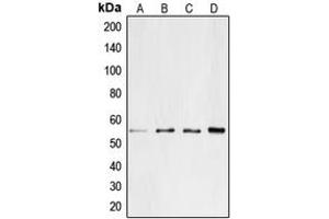 Western blot analysis of CD4 expression in Jurkat (A), SP2/0 (B), PC12 (C), H9C2 (D) whole cell lysates. (CD4 anticorps  (C-Term))