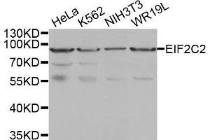 Western Blotting (WB) image for anti-Argonaute 2 (AGO2) antibody (ABIN1877052) (AGO2 anticorps)