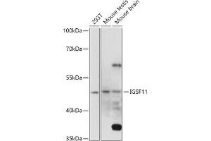 Western blot analysis of extracts of various cell lines, using IGSF11 antibody (ABIN7267849) at 1:1000 dilution. (IGSF11 anticorps  (AA 80-200))
