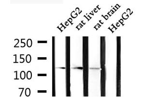 Western blot analysis of extracts from HepG2, rat liver and rat brain, using CLIP2 Antibody. (CLIP2 anticorps  (C-Term))