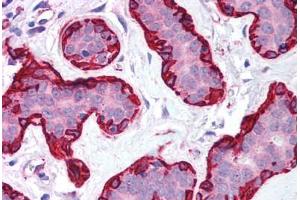 Human Breast (formalin-fixed, paraffin-embedded) stained with ACTA2 antibody ABIN213651 at 5 ug/ml followed by biotinylated goat anti-rabbit IgG secondary antibody ABIN481713, alkaline phosphatase-streptavidin and chromogen. (Smooth Muscle Actin anticorps  (N-Term))