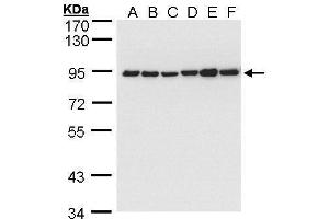 WB Image Sample (30 ug of whole cell lysate) A: 293T B: A431 , C: H1299 D: HeLa S3 E: Hep G2 , F: Molt-4 , 7.