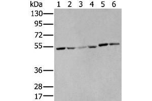 Western Blotting (WB) image for anti-Matrix Metallopeptidase 1 (Interstitial Collagenase) (MMP1) antibody (ABIN2427602) (MMP1 anticorps)