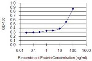 Detection limit for recombinant GST tagged MYO1E is 0.