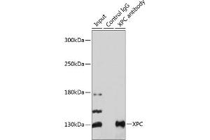 Immunoprecipitation analysis of 200 μg extracts of 293T cells using 3 μg XPC antibody ( ABIN6128932, ABIN6150295, ABIN6150296 and ABIN6224381). (XPC anticorps  (AA 700-940))