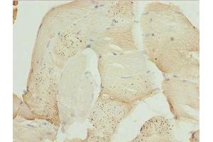 Immunohistochemistry of paraffin-embedded human skeletal muscle tissue using ABIN7175976 at dilution of 1:100