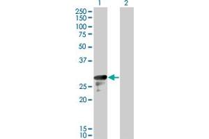 Western Blot analysis of DENR expression in transfected 293T cell line by DENR monoclonal antibody (M01), clone 1H3. (Density Regulated Protein anticorps  (AA 1-81))