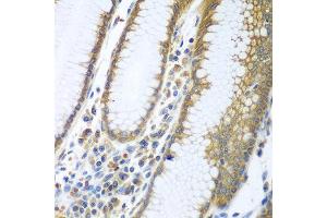 Immunohistochemistry of paraffin-embedded human stomach using FUT6 antibody at dilution of 1:100 (40x lens). (FUT6 anticorps)